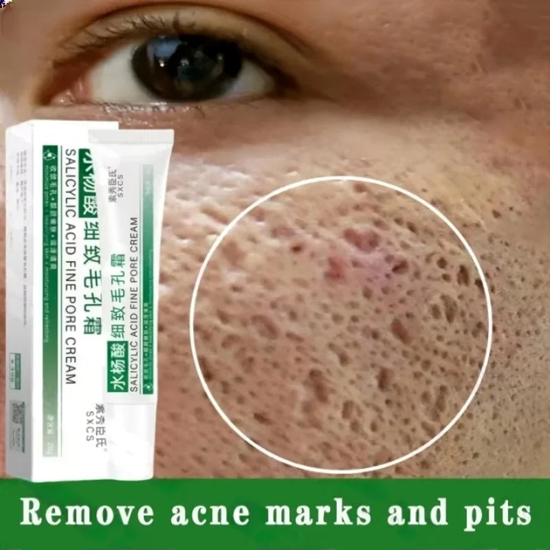 살리실산 모공 클리어링 크림 모공 축소 블랙헤드 제거  - Skincare Salicylic Acid 리뷰 및 가격