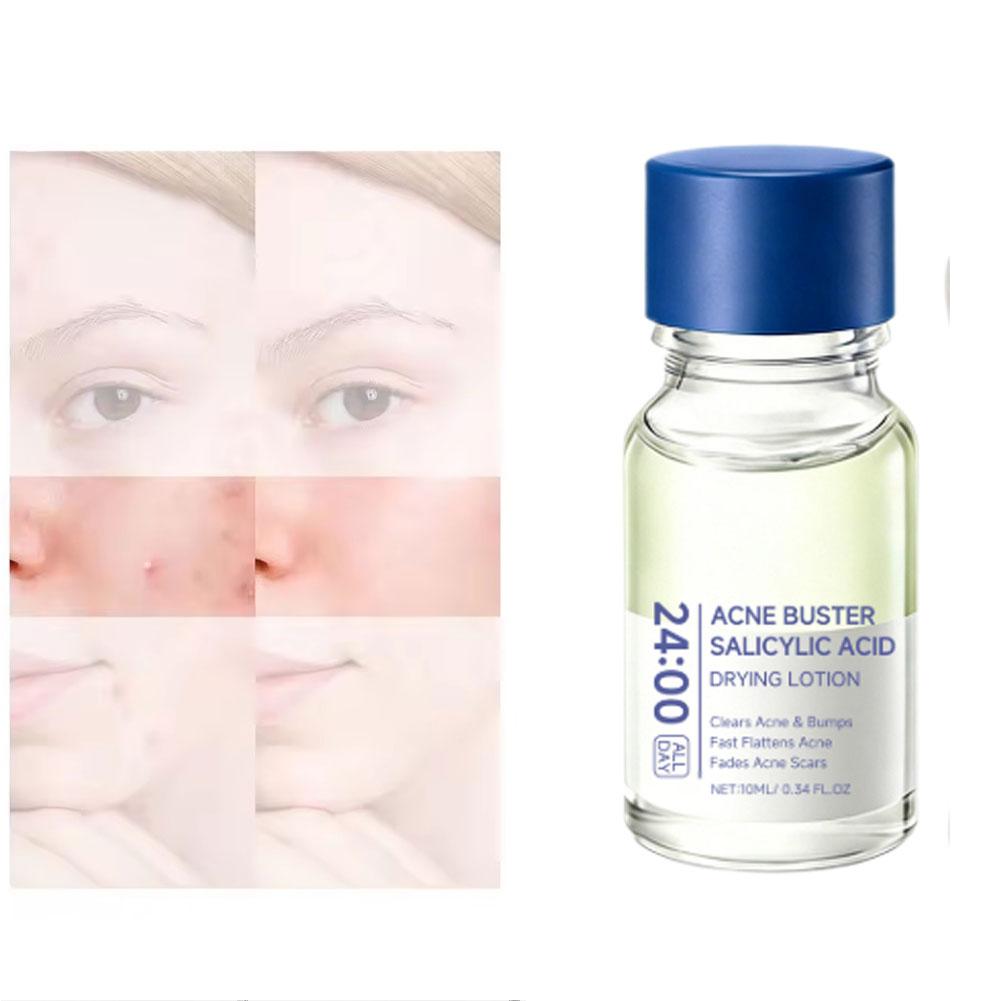살리실산 에센스 트리트먼트 로션 드라잉 로션 페이스 세 - Skincare Salicylic Acid 리뷰 및 가격