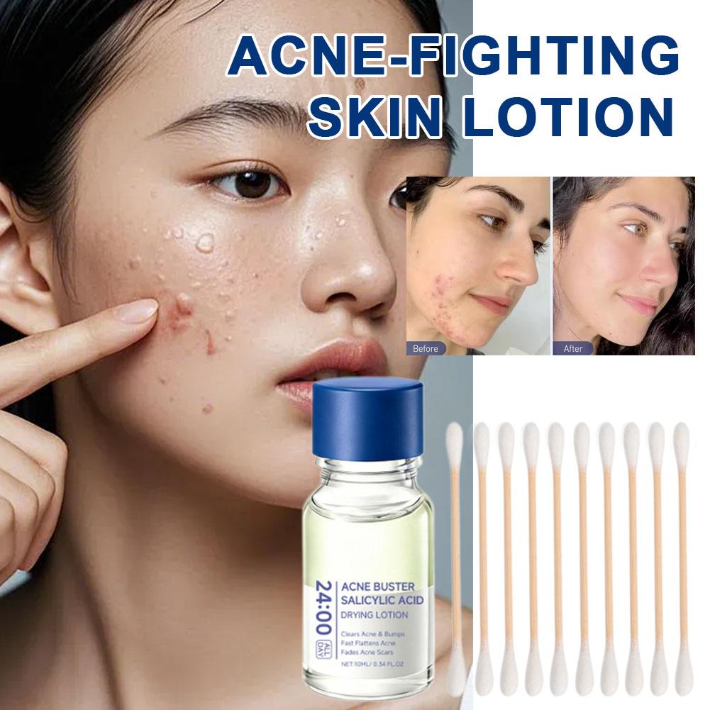 살리실산 에센스 트리트먼트 로션 드라잉 로션 페이스 세 - Skincare Salicylic Acid 리뷰 및 가격